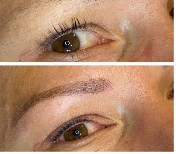 Eyeliner Tattooing Before and After Photos